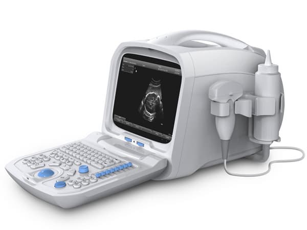 A60 Full Digital Portable Ultrasonic Diagnostic System